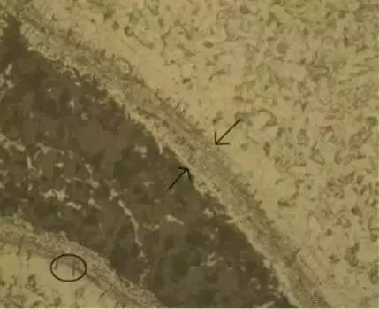 品成金屬制品:典型的鍛造裂紋示例 品成金屬制品:典型的鍛造裂紋示例